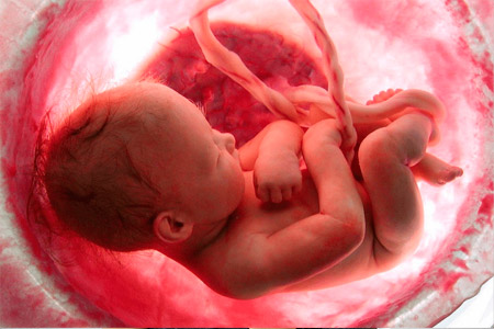 fetal